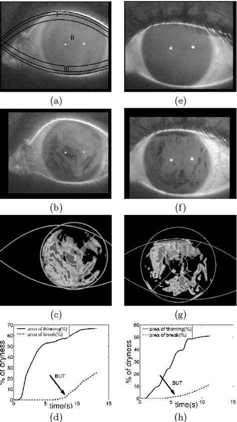 preocular tear film test